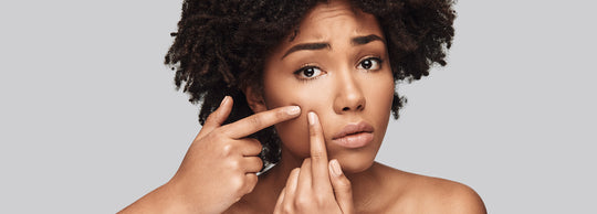 Acne scars dragging you down? You need to try these ingredients…